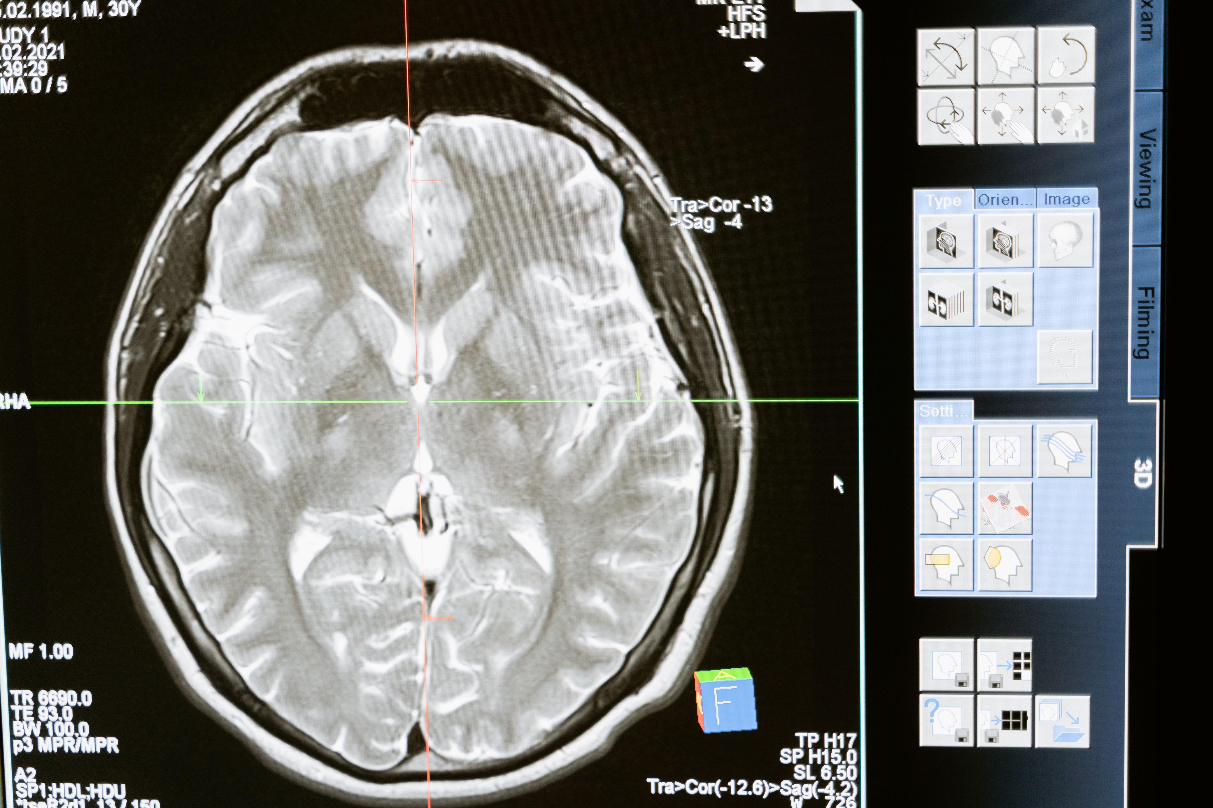 Protocolo NeuroVida